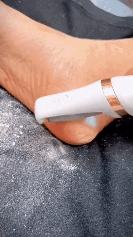 Limpador de Pés SoftFeet™